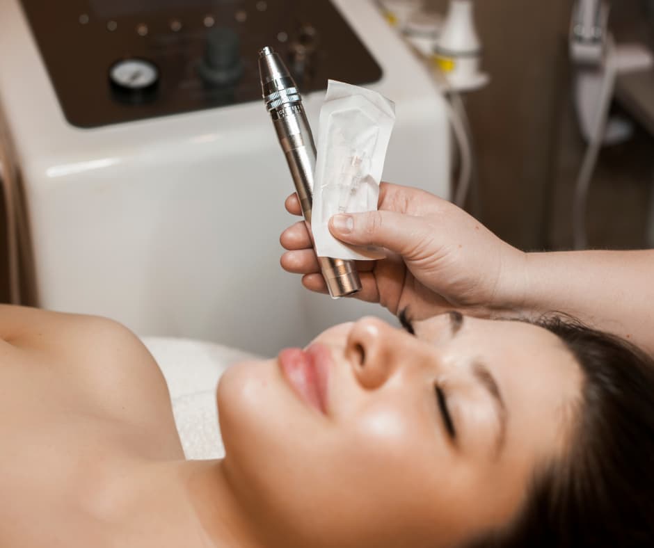 microneedling-lorsch